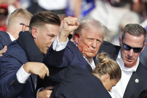 特朗普遇襲后發(fā)聲:右耳被擊穿